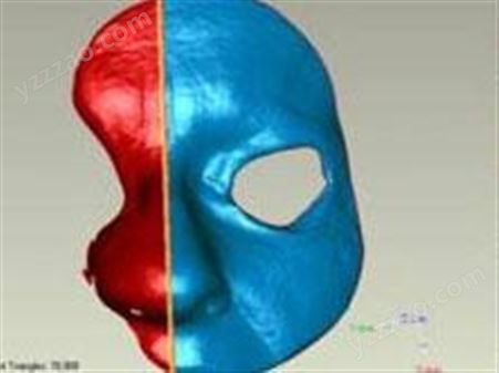 【行业应用】CREAFORM 的 GO!SCAN 3D：重建鼻子，争得与癌症搏斗的胜利