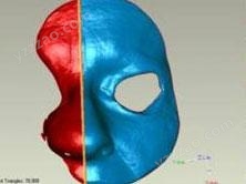 【行业应用】CREAFORM 的 GO!SCAN 3D：重建鼻子，争得与癌症搏斗的胜利